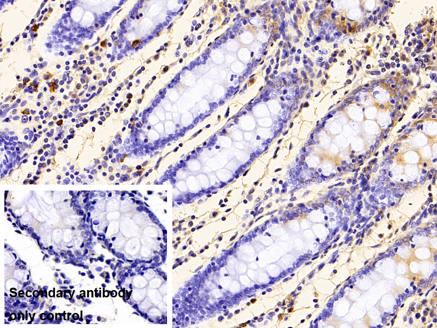 Polyclonal Antibody to Cystatin A (CSTA)