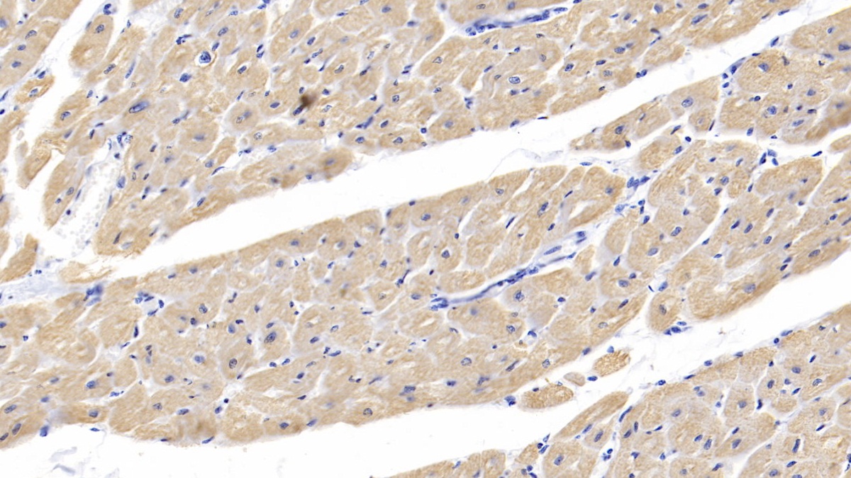 Polyclonal Antibody to Cardiac Troponin I (cTnI)