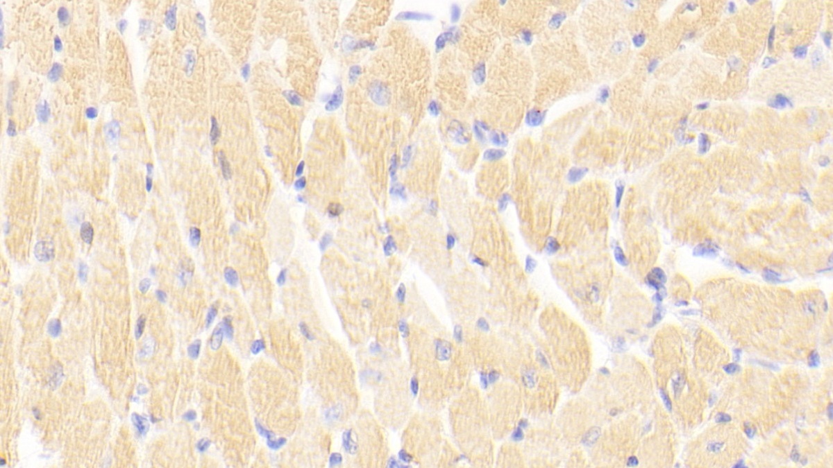 Polyclonal Antibody to Cardiac Troponin I (cTnI)