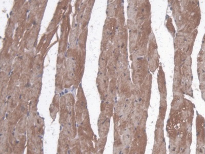 Polyclonal Antibody to Myoglobin (MYO)