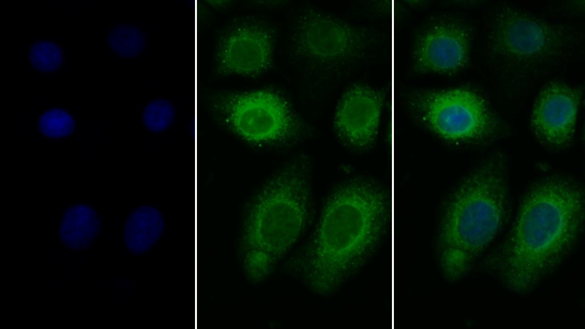 Polyclonal Antibody to Endothelin 1 (EDN1)