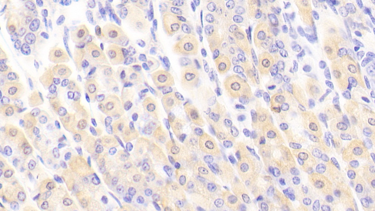 Polyclonal Antibody to N-Terminal Pro-Atrial Natriuretic Peptide (NT-ProANP)