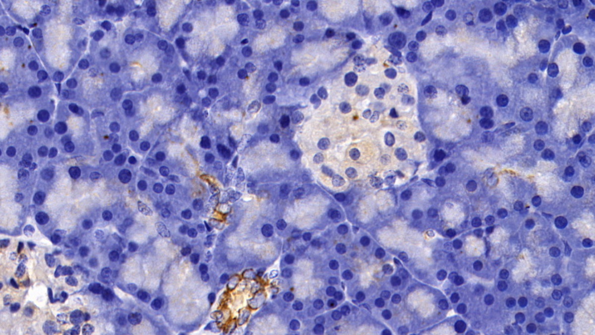 Polyclonal Antibody to Cytokeratin 5 (CK5)