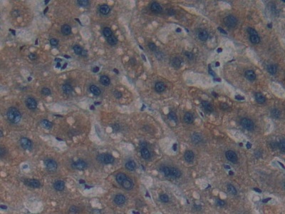 Polyclonal Antibody to Cytokeratin 4 (CK4)