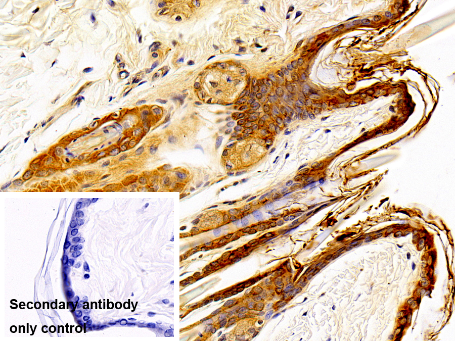 Polyclonal Antibody to Cytokeratin 1 (CK1)