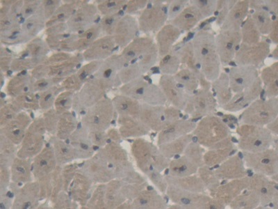 Polyclonal Antibody to Natriuretic Peptide Precursor B (NPPB)