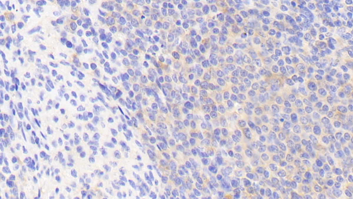 Polyclonal Antibody to Fibrinogen Like Protein 2 (FGL2)