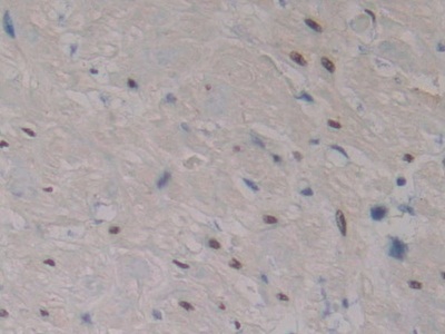 Polyclonal Antibody to Serum Response Factor (SRF)