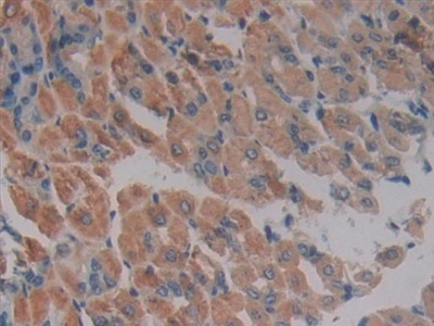 Polyclonal Antibody to Protein Kinase R (PKR)