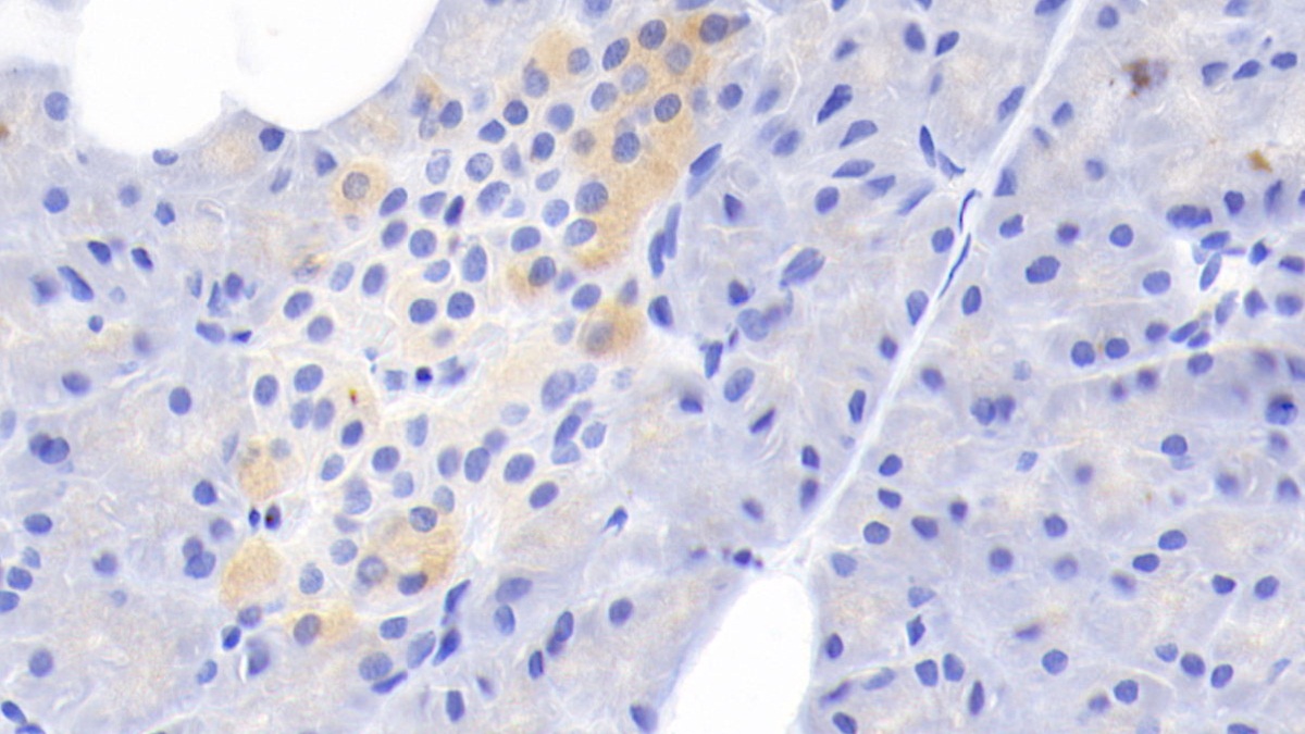 Polyclonal Antibody to Tissue Factor (TF)