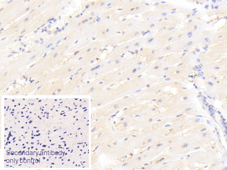 Polyclonal Antibody to Thrombomodulin (TM)