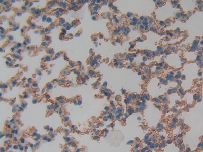 Polyclonal Antibody to Thrombomodulin (TM)