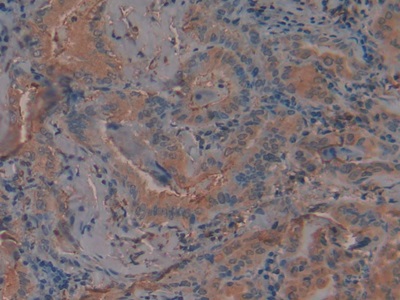 Polyclonal Antibody to Plasminogen Activator Inhibitor 1 (PAI1)