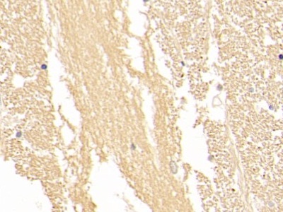 Polyclonal Antibody to Enolase, Neuron Specific (NSE)