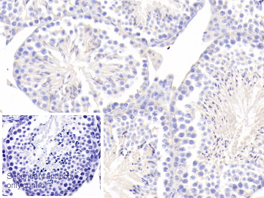 Polyclonal Antibody to Enolase, Neuron Specific (NSE)