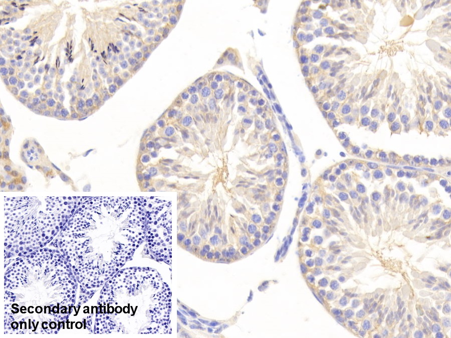 Polyclonal Antibody to Enolase, Neuron Specific (NSE)