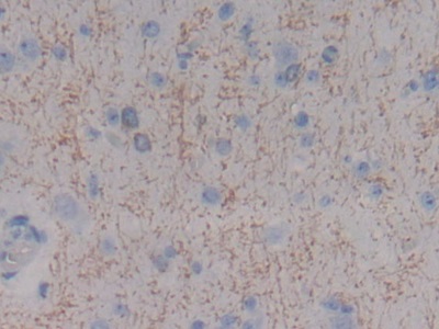 Polyclonal Antibody to Myelin Basic Protein (MBP)