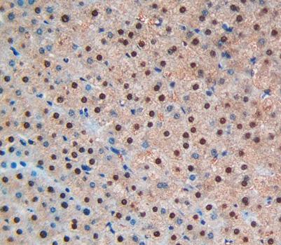 Polyclonal Antibody to Brain Natriuretic Peptide (BNP)