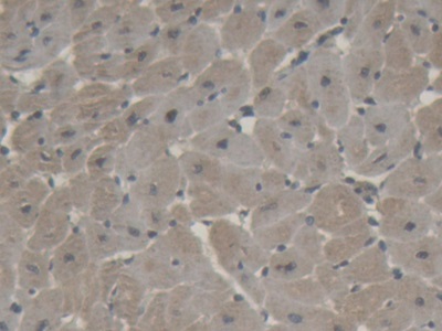 Polyclonal Antibody to Brain Natriuretic Peptide (BNP)
