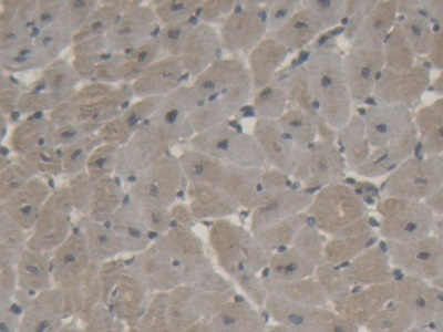 Polyclonal Antibody to Brain Natriuretic Peptide (BNP)