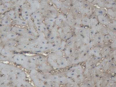 Polyclonal Antibody to Immunoglobulin G (IgG)