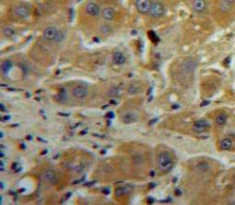 Polyclonal Antibody to Tissue Inhibitors Of Metalloproteinase 1 (TIMP1)