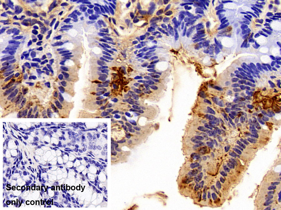 Polyclonal Antibody to Fatty Acid Binding Protein 2, Intestinal (FABP2)