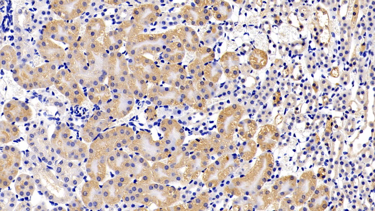 Polyclonal Antibody to Leukemia Inhibitory Factor Receptor (LIFR)