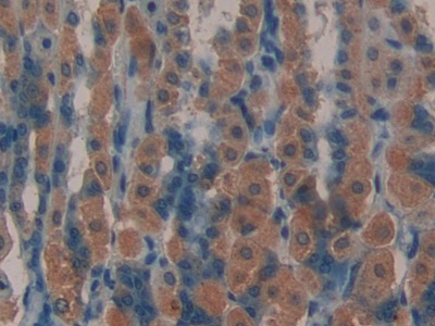 Polyclonal Antibody to Leukemia Inhibitory Factor Receptor (LIFR)