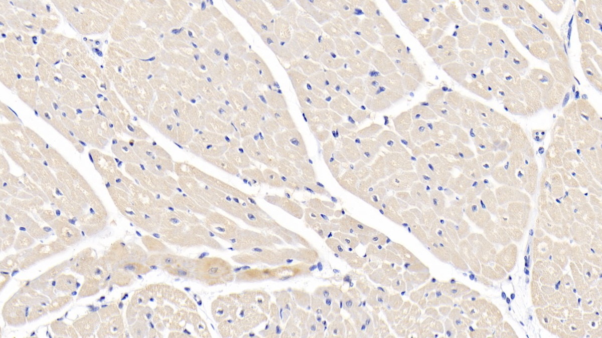 Polyclonal Antibody to Interleukin 1 Beta (IL1b)