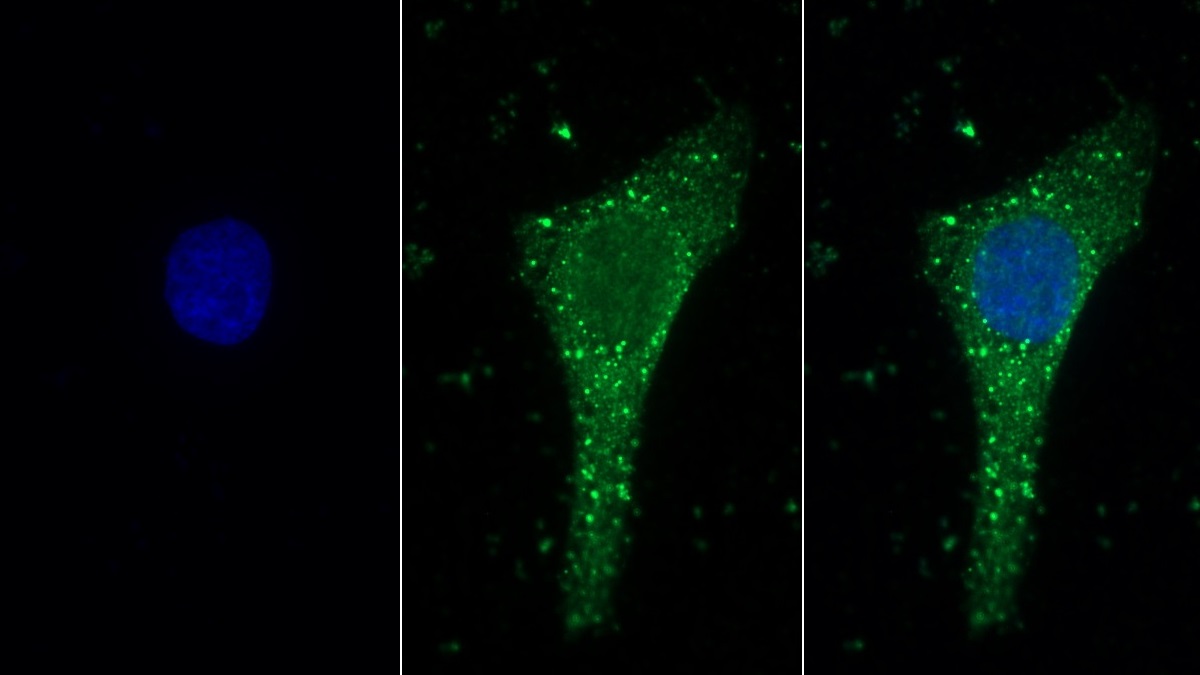 Polyclonal Antibody to Laminin Alpha 1 (LAMA1)