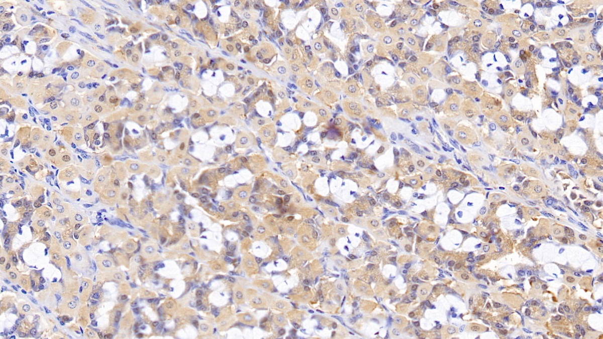 Polyclonal Antibody to Motilin (MTL)