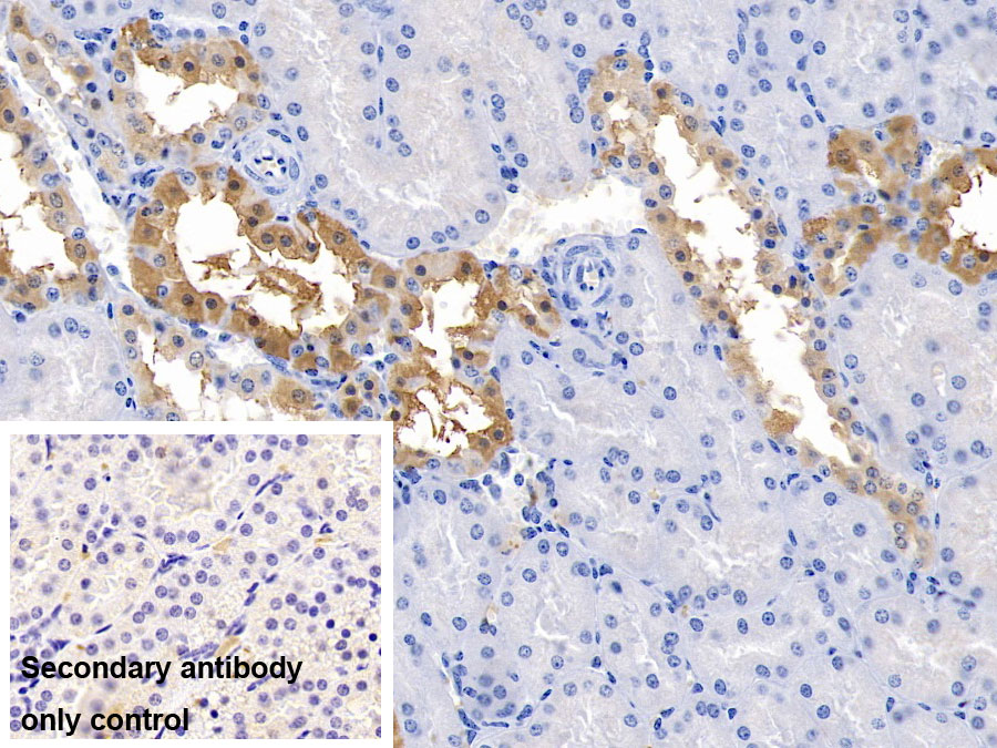 Polyclonal Antibody to Aquaporin 3, Gill Blood Group (AQP3)