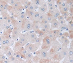 Polyclonal Antibody to Fibrillin 1 (FBN1)