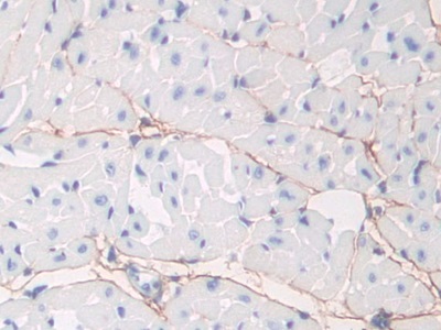 Polyclonal Antibody to Fibrillin 1 (FBN1)