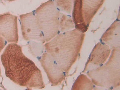 Polyclonal Antibody to Fibrillin 1 (FBN1)