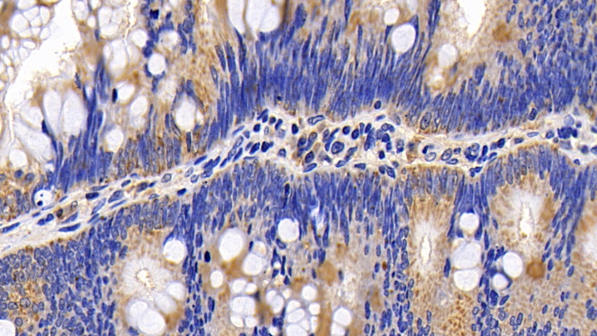 Polyclonal Antibody to Cytochrome C (CYCS)