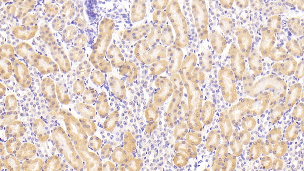 Polyclonal Antibody to Superoxide Dismutase Copper Chaperone