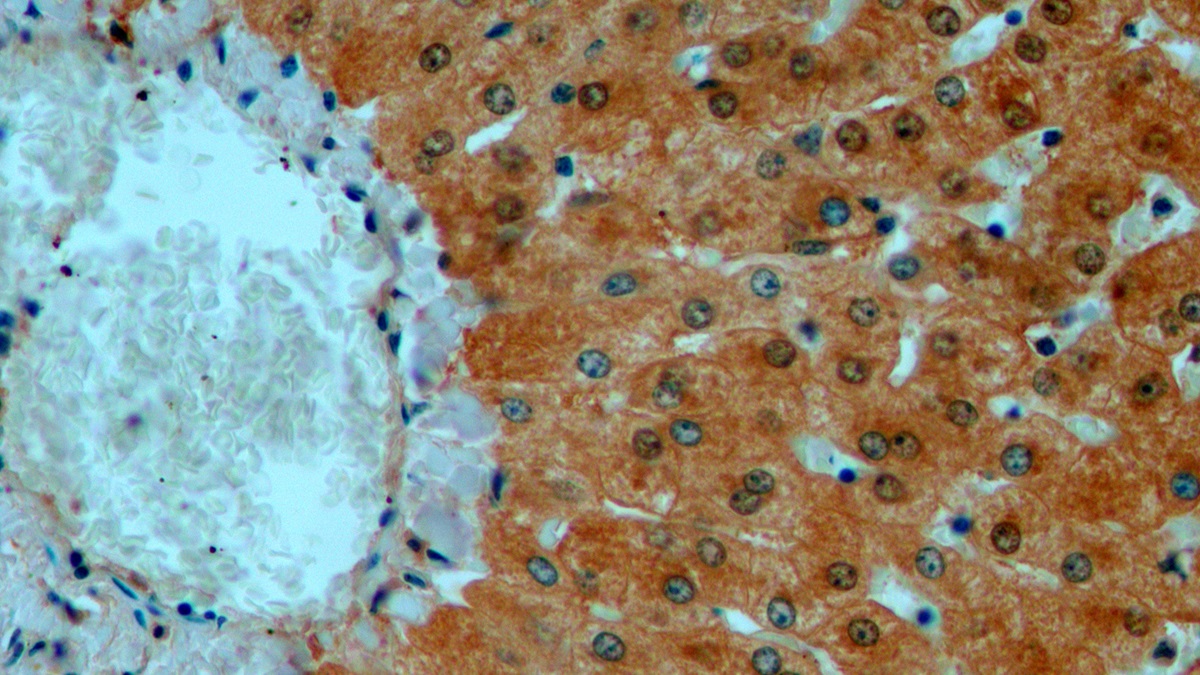 Polyclonal Antibody to Myeloperoxidase (MPO)