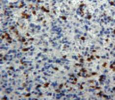 Polyclonal Antibody to Myeloperoxidase (MPO)