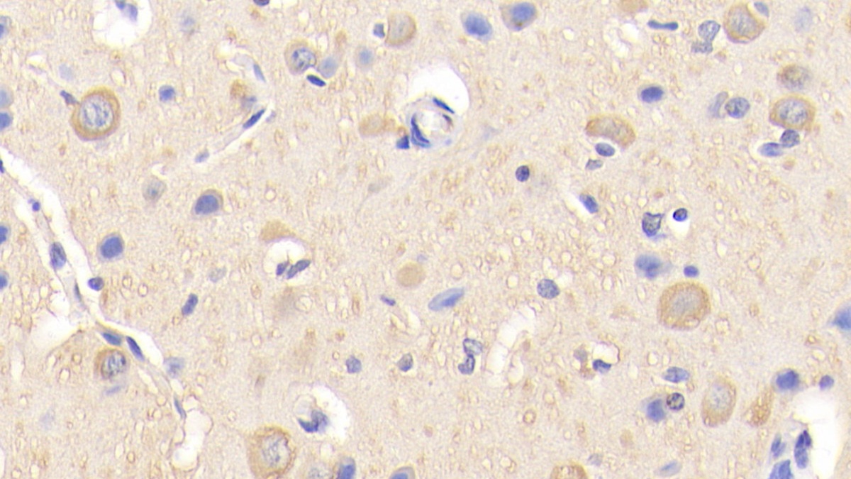 Polyclonal Antibody to Peroxisomal Biogenesis Factor 2 (PEX2)