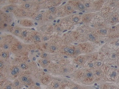 Polyclonal Antibody to Neuroglobin (NGB)