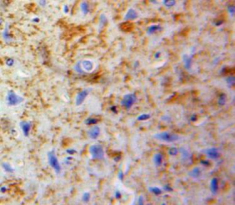 Polyclonal Antibody to Neuroglobin (NGB)