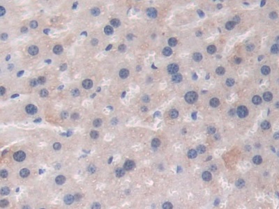 Polyclonal Antibody to Thrombospondin 1 (THBS1)