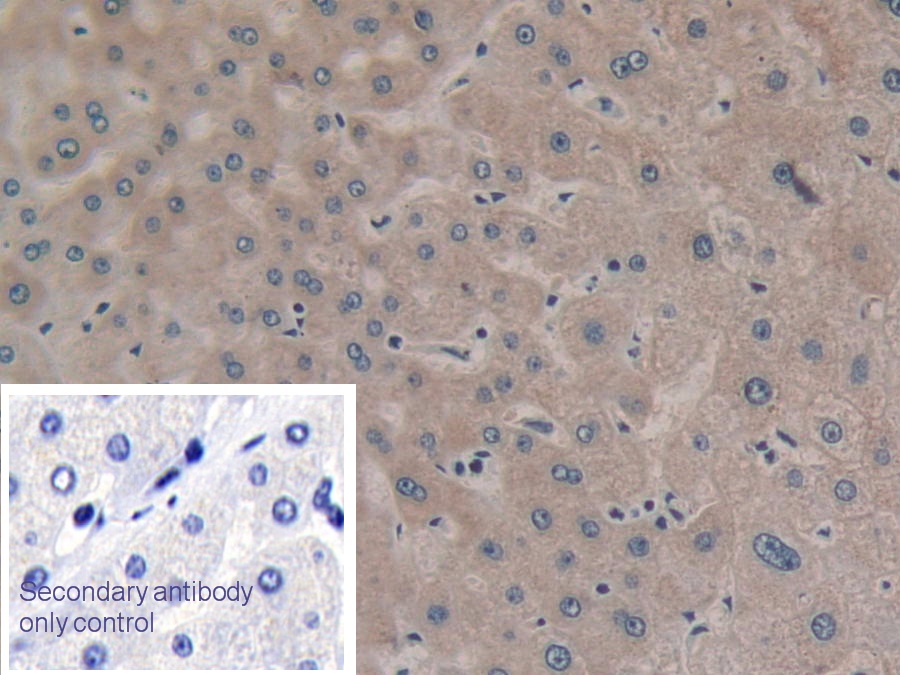 Polyclonal Antibody to Glutathione S Transferase Theta 2 (GSTt2)