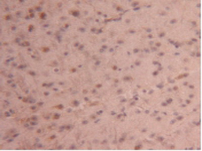 Polyclonal Antibody to Carboxypeptidase B2 (CPB2)