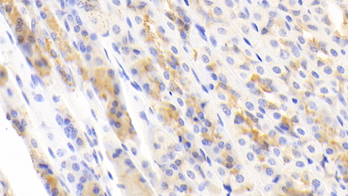 Polyclonal Antibody to Transcription Factor P65 (NFKB3)