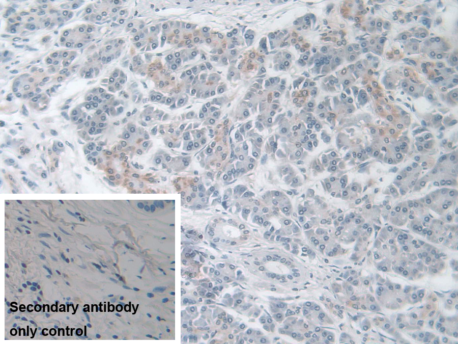 Polyclonal Antibody to Tachykinin Receptor 2 (TACR2)