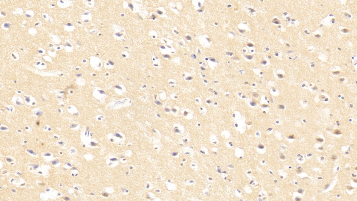 Polyclonal Antibody to Caspase 3 (CASP3)