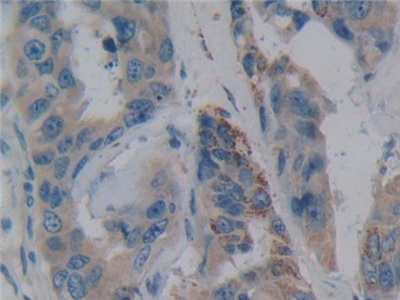 Polyclonal Antibody to Nitric Oxide Synthase Trafficker (NOSTRIN)